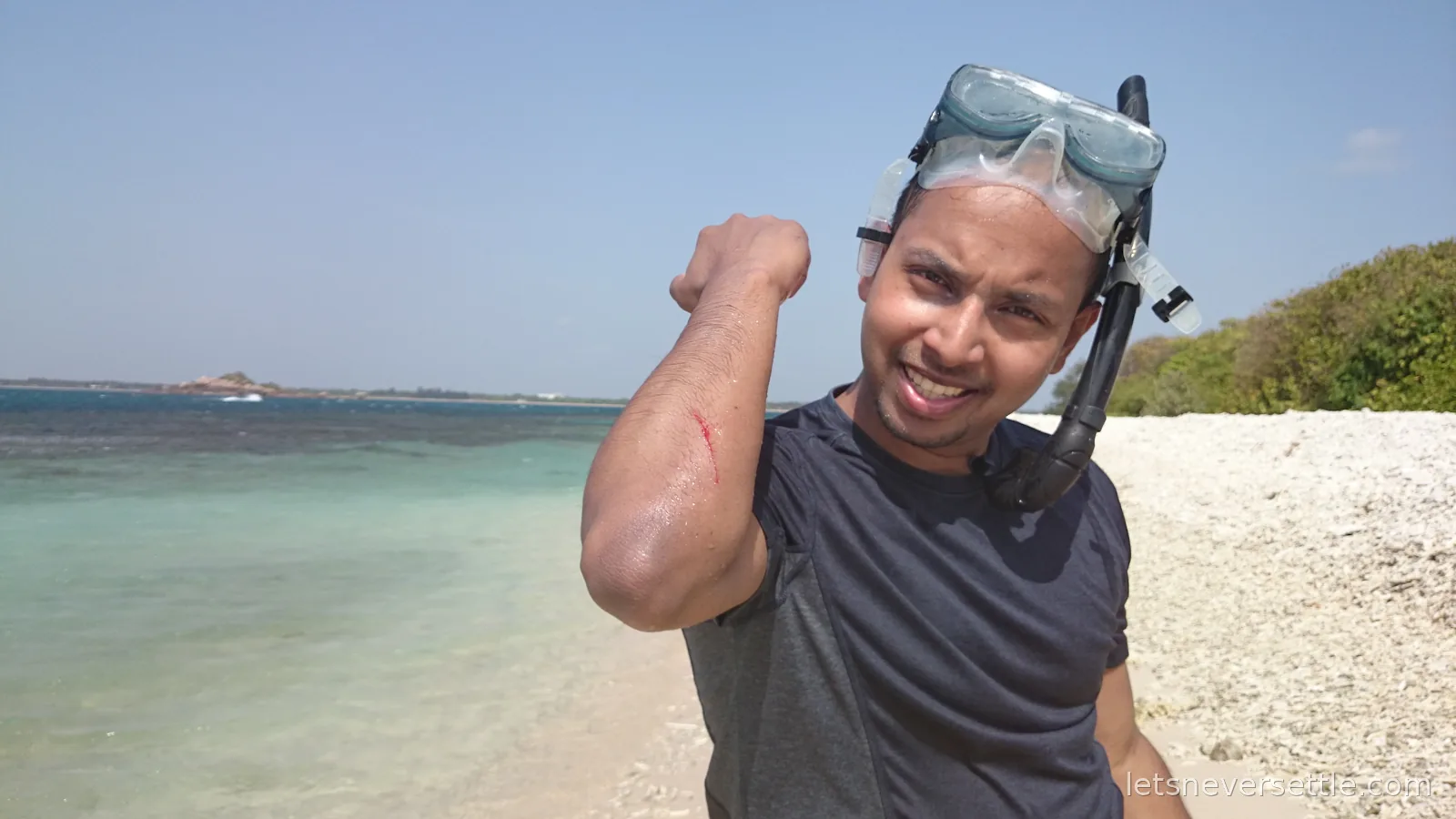 Dileep on the white coral beach of Pigeon Island with a snorkel mask on his head, showing a red scratch on his arm